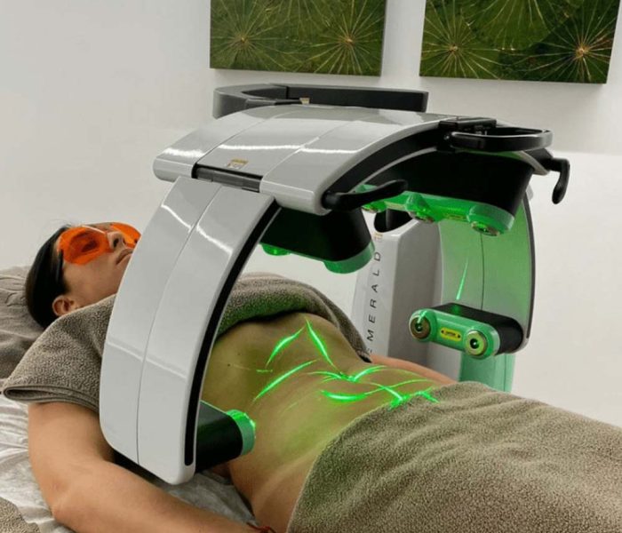Bariatric Laser- 4 Sessions